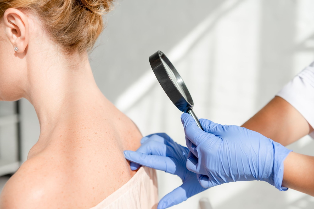 Dermatologista: Como Esse Especialista Pode Ajudar na Saúde da Sua Pele